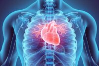 Pil Anti Inflamasi Murah Ini Dapat Mengurangi Risiko Serangan Jantung dan Stroke

