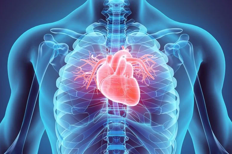 Pil Anti Inflamasi Murah Ini Dapat Mengurangi Risiko Serangan Jantung dan Stroke

