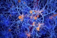 Sel Otak Tersembunyi Mungkin Memegang Kunci Alzheimer

