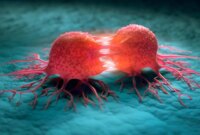 Senyawa Tumbuhan Alami Meningkatkan Kemoterapi Melawan Leukemia

