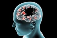Sleep Apnea Secara Dramatis Meningkatkan Risiko Parkinson, Studi Menemukan

